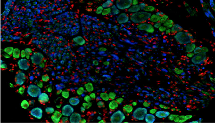 A cellular staining of a neuronal cell in blue, red and green 